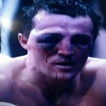 Денис Лебедев после боя с Гильермо Джонсом Денис Лебедев после боя с Гильермо Джонсом